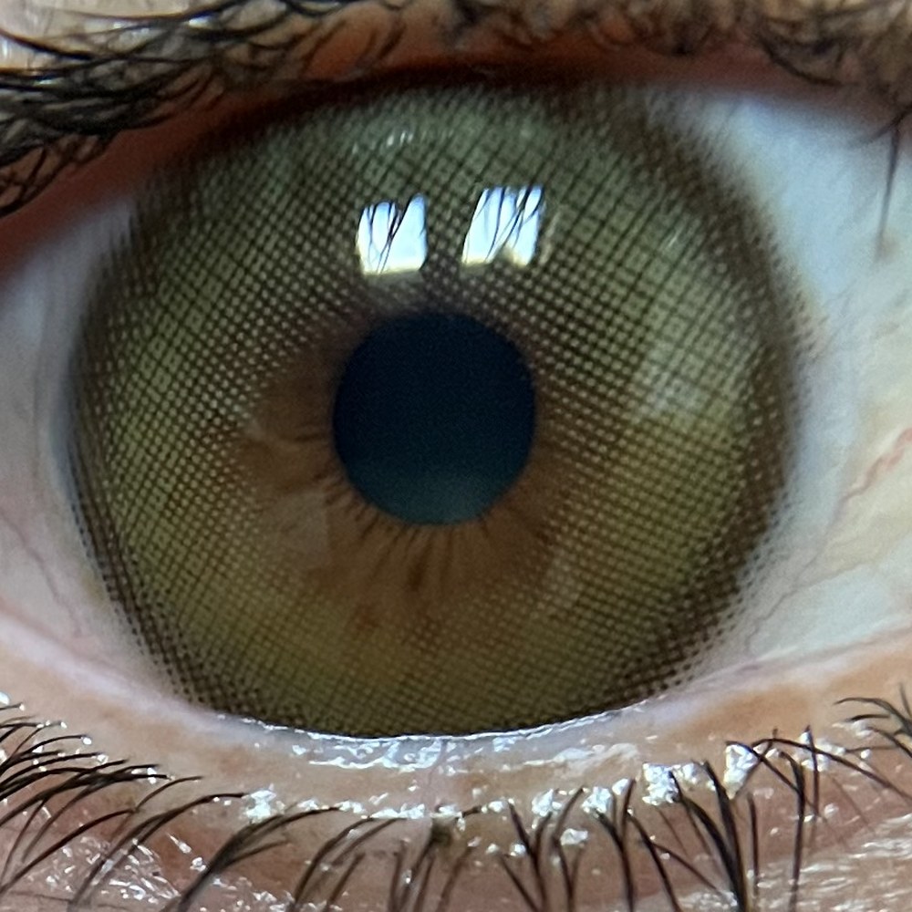 Lente de color sobre un ojo café real